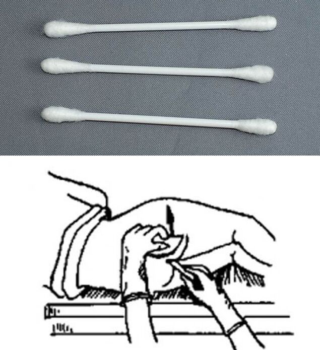 Analisi makilak