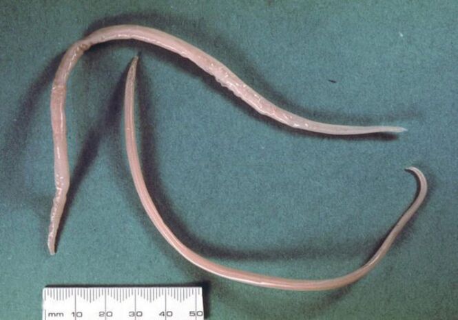 Asarids