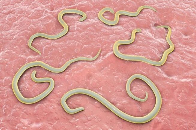 Zer dira Helminths