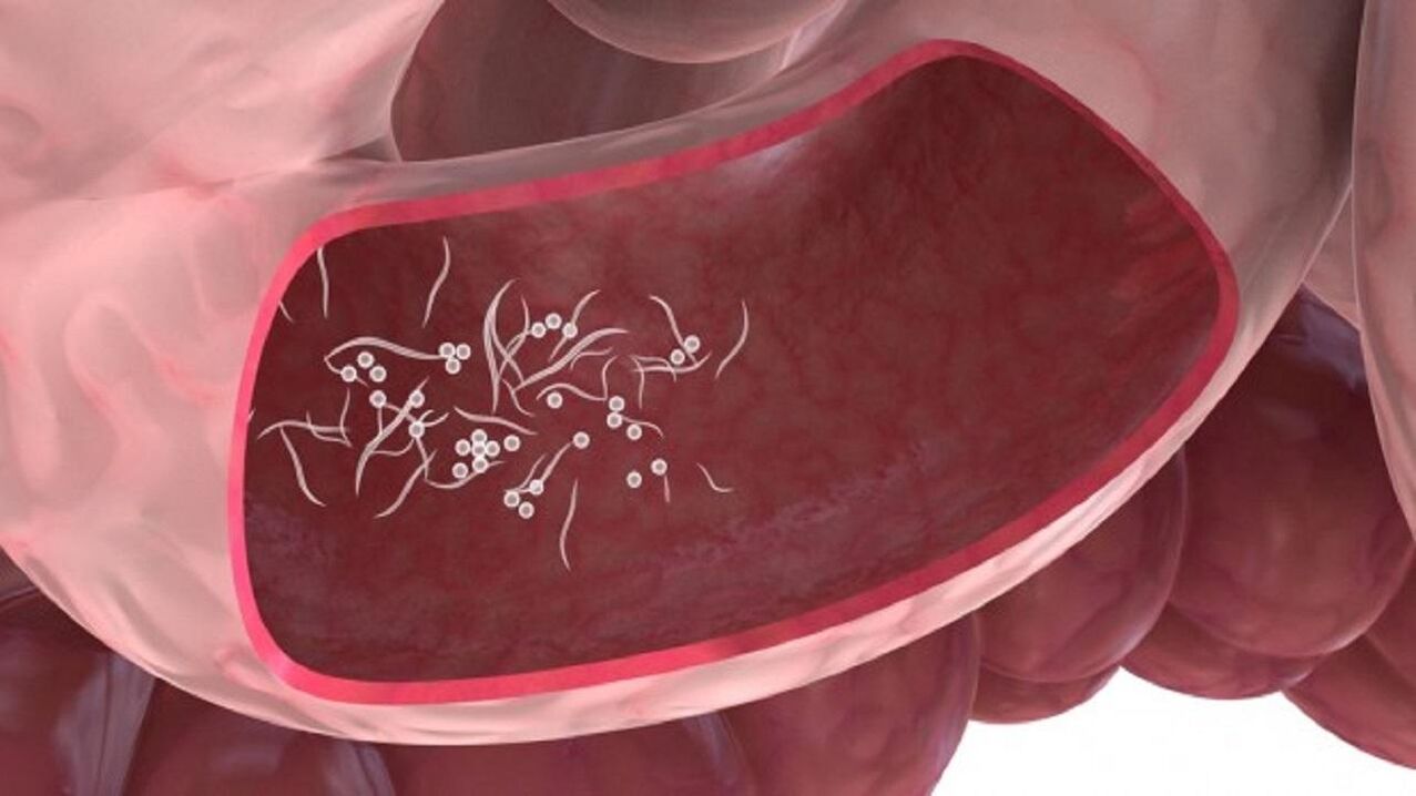 Giardia parasitoak gibelean