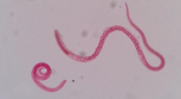 nolakoa da trikinela