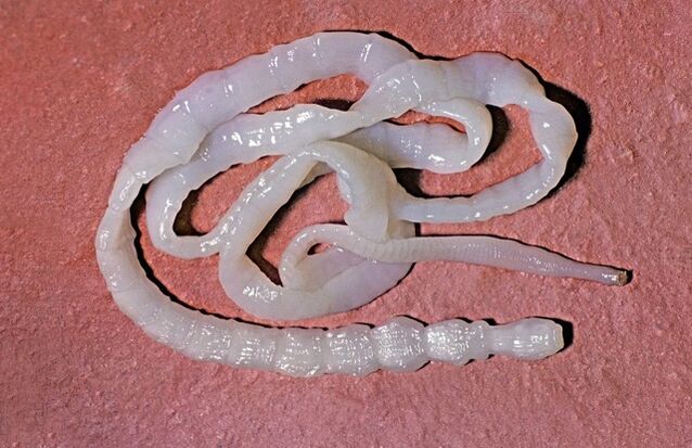 nolakoa da zezen-tenia