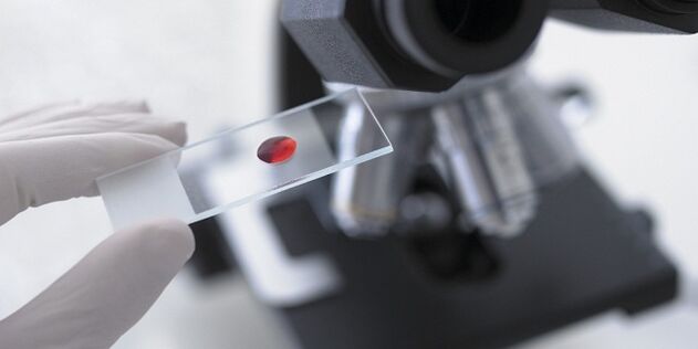 odol azterketa parasitoak gorputzean diagnostikatzeko